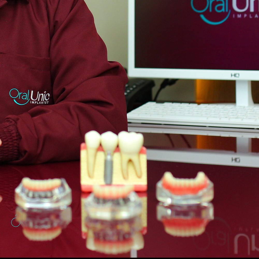 Modelos de prótese sobre implantes na mesa de avaliação da Oral Unic Lajeado